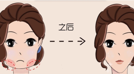 荊州市整形科下頜角手術(shù)價格透明嗎？以下是經(jīng)驗之談