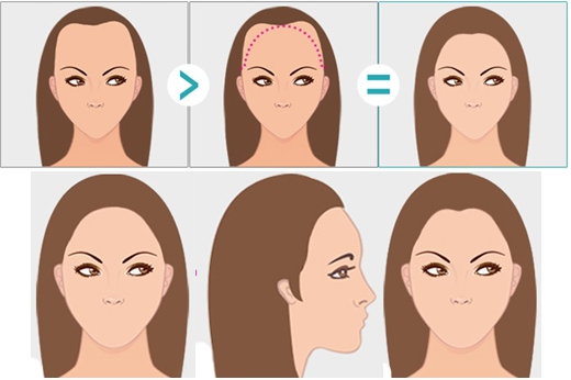 廈門大學(xué)附屬中山醫(yī)院整形美容外科植發(fā)靠譜嗎？技術(shù)水平和案例簡介