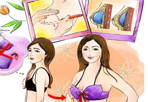 浙江中醫(yī)藥大學(xué)附屬第二醫(yī)院整形外科實(shí)力可靠嗎？假體隆胸案例反饋