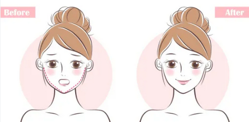 上海長海醫(yī)院整形科宋建星面部吸脂做得怎么樣？坐診醫(yī)生信息資料來襲！