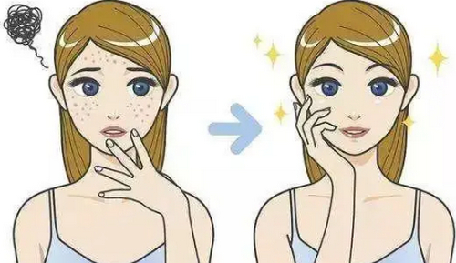 東莞厚街醫(yī)院美容科去斑多少錢？口碑怎么樣？案例效果反饋