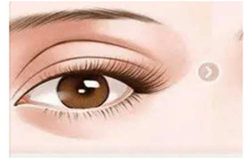 重慶鵬愛醫(yī)療美容醫(yī)院技術(shù)實力可靠嗎？雙眼皮案例分享，價格明細(xì)