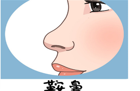 河南中醫(yī)藥大學第一附屬醫(yī)院整形美容科隆鼻案例分享，醫(yī)院簡介，戳進來了解