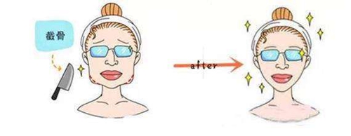 清遠華美整容醫(yī)院好不好？醫(yī)院信息、醫(yī)生行業(yè)經(jīng)驗、價格表供大家參考！