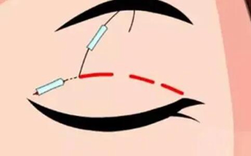 鄭州麗天整形美容醫(yī)院是正規(guī)醫(yī)院嗎？醫(yī)生簡介、口碑點評、價格表全面解答~