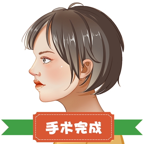 中日醫(yī)院整形科貴嗎？整形價格表及醫(yī)生提供給你參考！