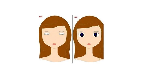 北京做雙眼皮多少錢?簡(jiǎn)介全新來襲！附價(jià)目表