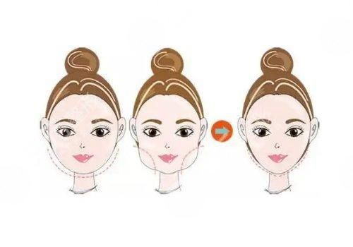 暨南大學(xué)附屬醫(yī)院整形科口碑怎么樣？簡介名單及擅長公開