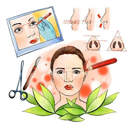 珠海愛思特美容?？漆t(yī)院怎么樣？本院資料/價格表2024攻略！