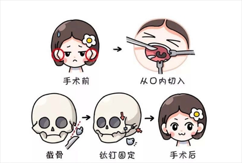 廣州可玉醫(yī)療美容門診部怎么樣？價(jià)格表更新！口碑反饋get~