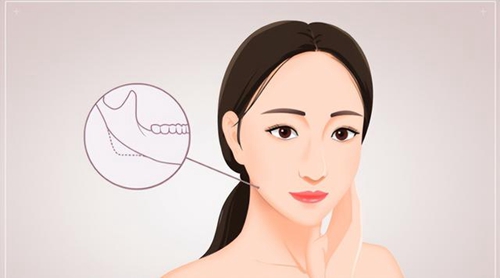 中日醫(yī)院整形外科怎么樣？擅長(zhǎng)項(xiàng)目介紹！