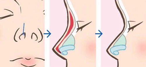 齊齊哈爾繡顏摯美醫(yī)療美容門診部評價怎么樣？全新公開！價格表參考~