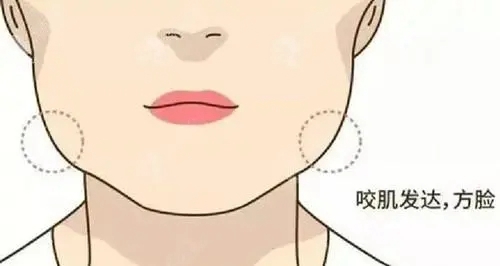 廣州荔灣區(qū)人民醫(yī)院整形科正規(guī)嗎？技術(shù)水平、口碑點(diǎn)評一覽_可預(yù)約！