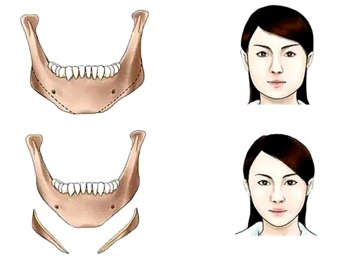宜興市人民醫(yī)院整形科好不好？醫(yī)院簡介及價格參考！