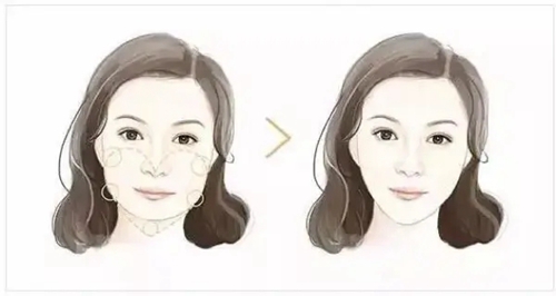 廣東省第二人民醫(yī)院整形科價(jià)格是多少？參考費(fèi)用分享！醫(yī)院口碑測評