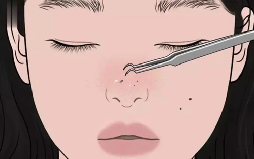 株洲愛(ài)思特醫(yī)療美容中心怎么樣？簡(jiǎn)介資料提前看，附上隆鼻案例