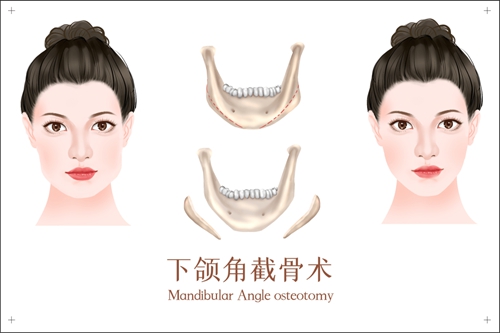 北京中醫(yī)藥大學(xué)東方醫(yī)院整形美容科好不好?專(zhuān)家簡(jiǎn)介|價(jià)格表多方面介紹