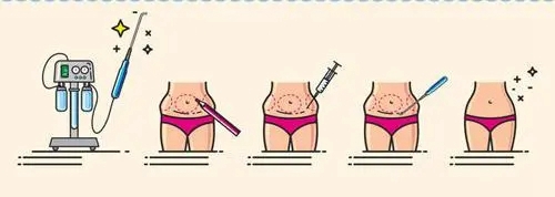 棗莊礦務(wù)局醫(yī)院美容整形中心口碑怎么樣？?jī)r(jià)格收費(fèi)+介紹了解