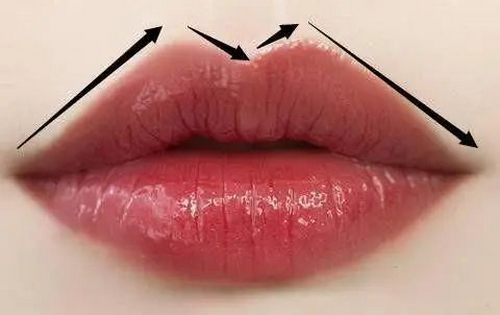 北京八大處尹寧北怎么樣？唇部修復(fù)手術(shù)案例效果\費用參考