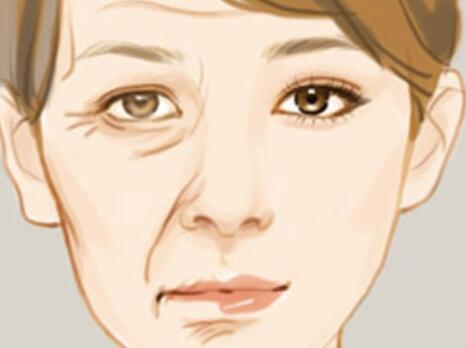 長沙去魚尾紋價(jià)格是多少？附上3家熱門醫(yī)院