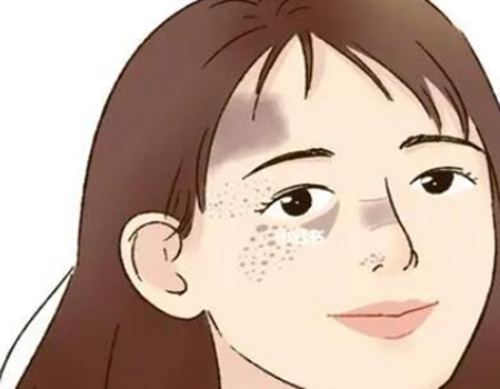 成都激光祛斑多少錢？四川美萊、米蘭柏羽、成都銅雀臺網(wǎng)友力薦