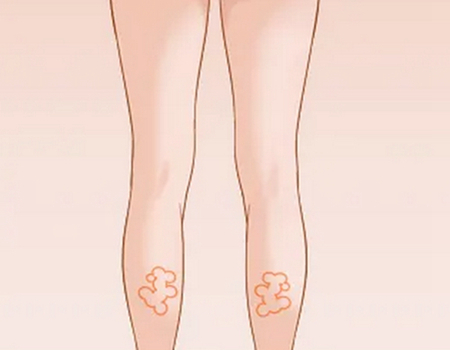 福州瘦小腿價(jià)格多少?醫(yī)院名單咨詢和價(jià)格信息更新