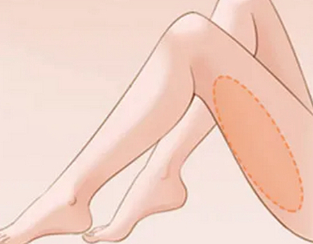 中國大腿抽脂多少錢？抽脂實力醫(yī)院名單公布