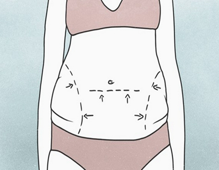 南京吸脂價(jià)格貴不貴？更新口碑靠前的三家醫(yī)院