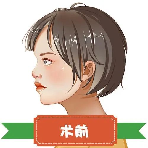 解放軍第211醫(yī)院整形美容中心隆鼻適合哪些人，技術不錯，值得選擇~