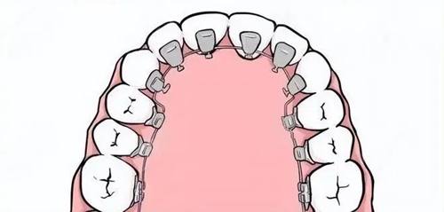 開(kāi)封市第二人民醫(yī)院口腔科技術(shù)好嗎?醫(yī)生測(cè)評(píng)、熱門項(xiàng)目技術(shù)對(duì)比！