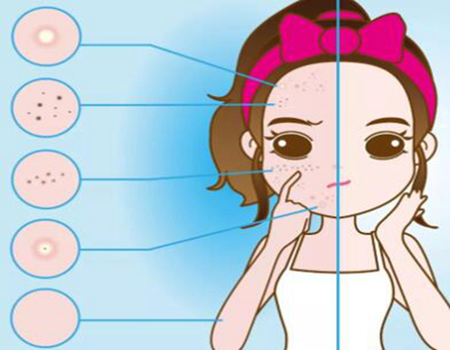 重慶激光祛斑格價(jià)格是多少？力推三強(qiáng)醫(yī)院名單供大家挑選