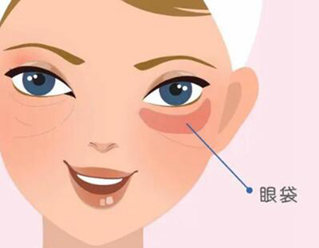 武漢做眼袋手術(shù)價(jià)格多少？價(jià)格咨詢和醫(yī)院信息盤點(diǎn)