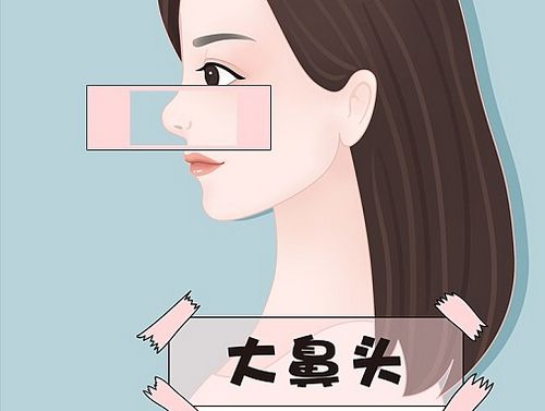 首都醫(yī)科大學附屬北京世紀壇醫(yī)院整形外科隆鼻手術后怎么護理，口碑醫(yī)院值得了解收藏!