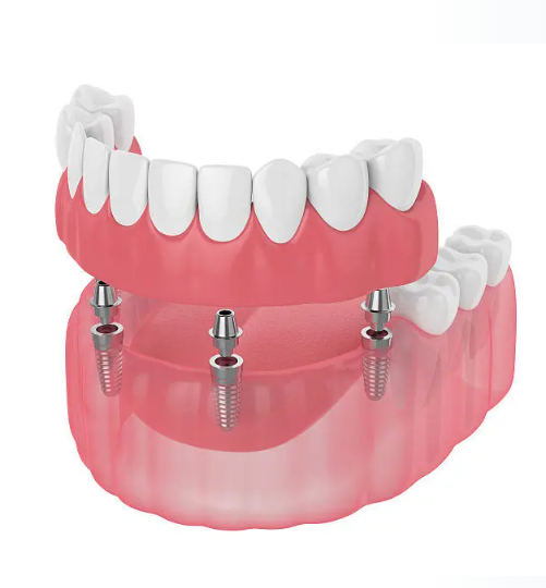 廣東省湛江牙科防治所怎么樣？附帶醫(yī)院信息以及真人案例反饋