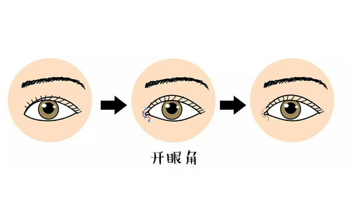 鄭州隴海醫(yī)院整形科開眼角真實(shí)體驗(yàn)反饋+科室介紹