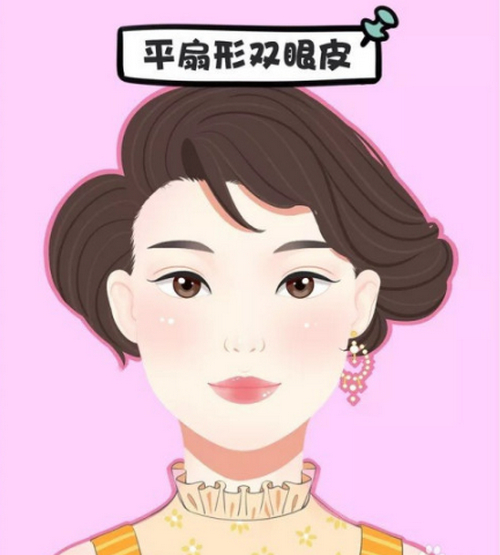 重慶市第六人民醫(yī)院整形美容外科做雙眼皮怎么樣?案例效果分享