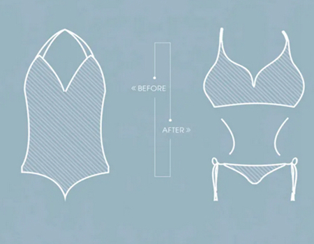 中山水滴型假體豐胸價(jià)格多少？更新口碑整形醫(yī)院資料