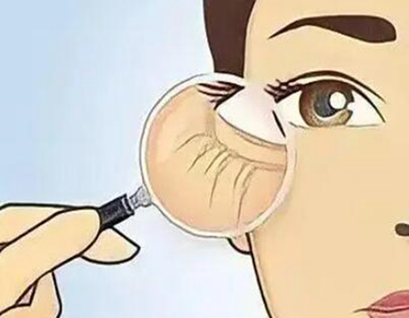 天津玻尿酸填充法令紋多少錢? 更新口碑整形醫(yī)院資料供參考