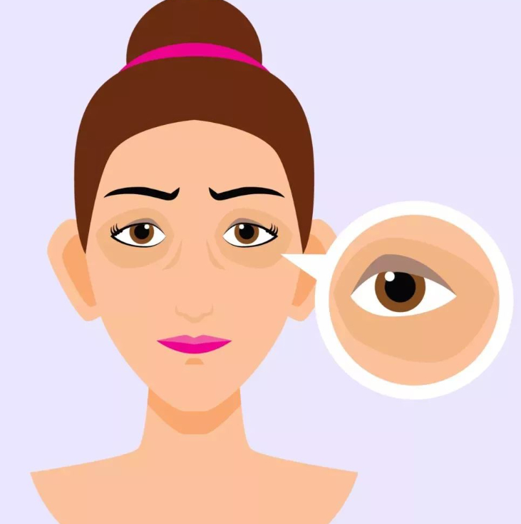 福州名韓醫(yī)療美容醫(yī)院做眼袋怎么樣？內(nèi)切去眼袋術(shù)后反饋+醫(yī)院資料