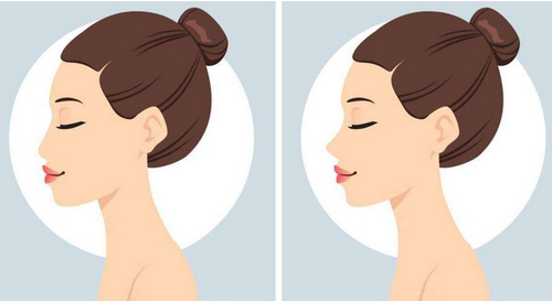 成都416醫(yī)院整形美容科假體隆鼻技術(shù)如何？附真實案例+用戶評價