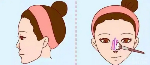 蘇州眼耳鼻喉科醫(yī)院醫(yī)療美容科隆鼻案例分享+科室介紹