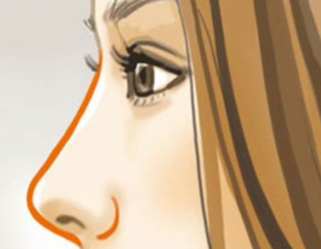 西安自體軟骨隆鼻價格是多少？西京、唐都、省人民醫(yī)院等力薦