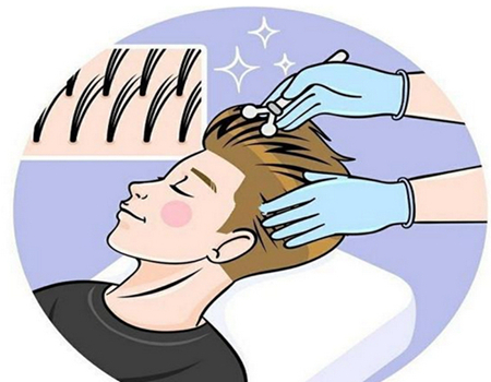 西安種發(fā)際線(xiàn)多少錢(qián)？查詢(xún)口碑植發(fā)機(jī)構(gòu)資料