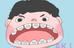 牙齒矯正17.png 牙齒矯正17.png