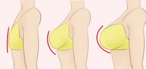 鄭大一附院整形外科隆胸案例反饋，內(nèi)附價格表|醫(yī)院信息