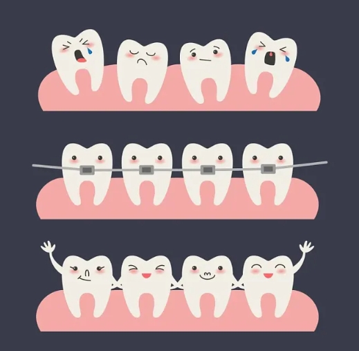 唐山牙博士口腔醫(yī)院牙齒矯正好不好?專家技術(shù)好|正畸案例效果反饋