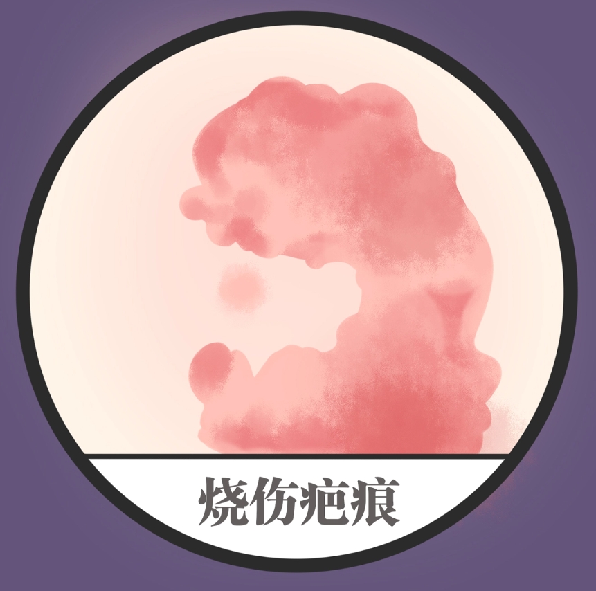 煙臺市煙臺山醫(yī)院燒傷整形外科疤痕手術(shù)怎么樣？費用價格明細和真人案例