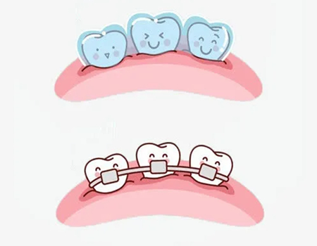 大連做矯正牙齒價(jià)格貴嗎？熱門醫(yī)院信息速看