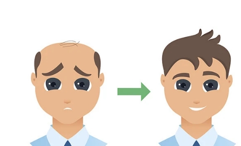 信陽市中心醫(yī)院整形科植發(fā)多少錢？成功案例分享