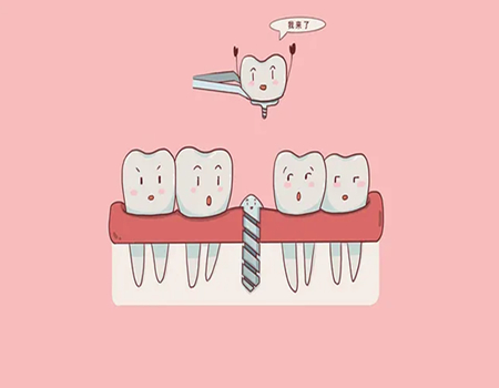 蘇州種植牙價格是多少？醫(yī)院推薦、價格參考一覽